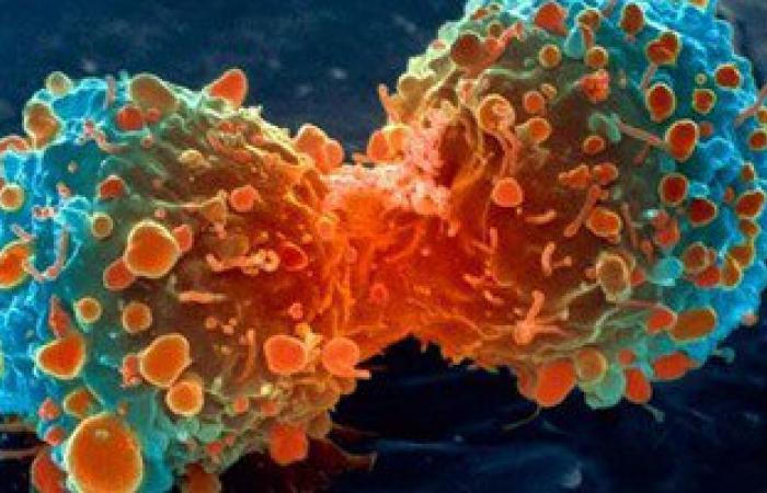 دراسة:20% من أمراض السرطان يمكن تجنبها باتباع أسلوب حياة صحى