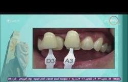 8 الصبح - بالصور | بعض الحالات العلاجية للأسنان لـ د/حازم غنيم أخصائي تجميل الأسنان