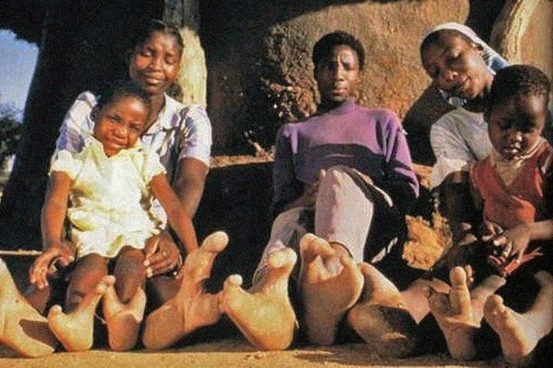 أغرب القبائل.. &amp;quot;الفادوما&amp;quot; الإفريقية أقدامهم بلا أصابع ويعبدون &amp;quot;الأشجار&amp;quot; ويأكلونها في الوقت نفسه