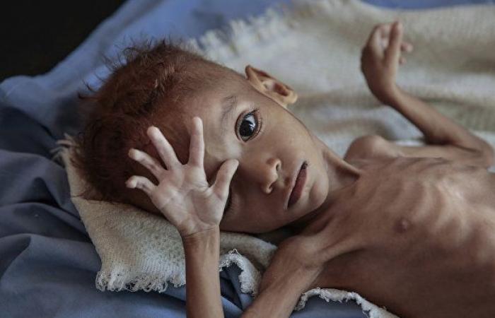 اليمن... أمومة وأبوة تحت القصف... مآسي إنسانية وكوارث اجتماعية
