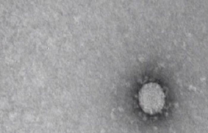 10 حالات مصابة بفيروس كورونا داخل الاردن ... و4 اصابات على الحدود