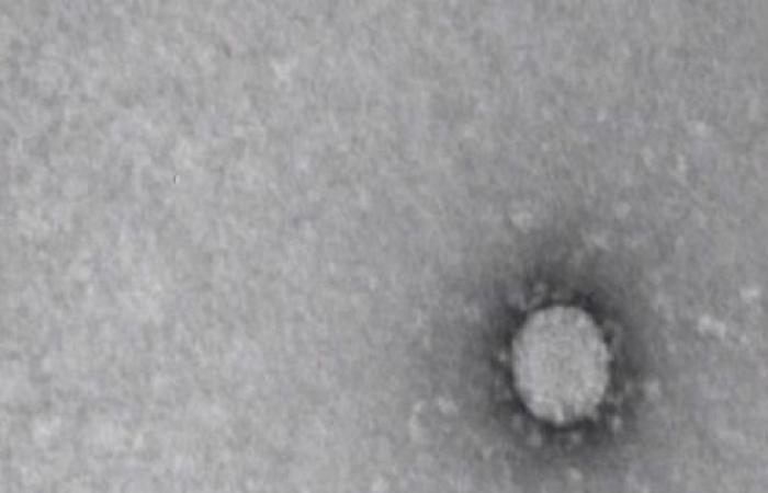6 اصابات جديدة مصابة بفيروس كورونا