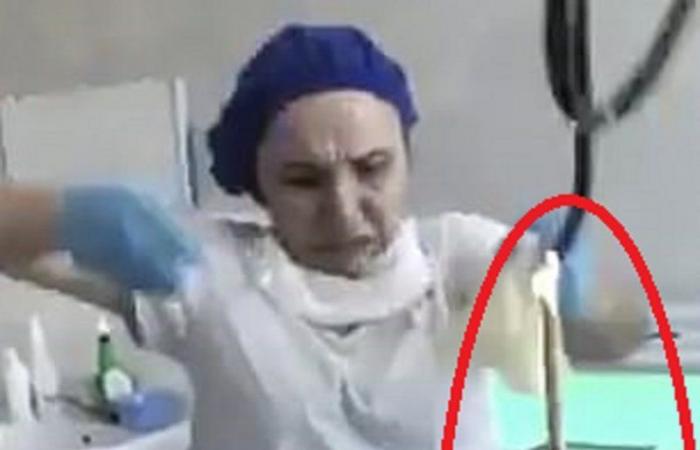 فيديو غرفة العمليات.. لحظة استخراج ثعبان من جسد امرأة