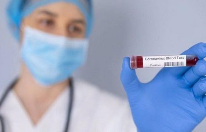 تسجيل 8 وفيات و599 إصابة بفيروس كورونا في الاردن