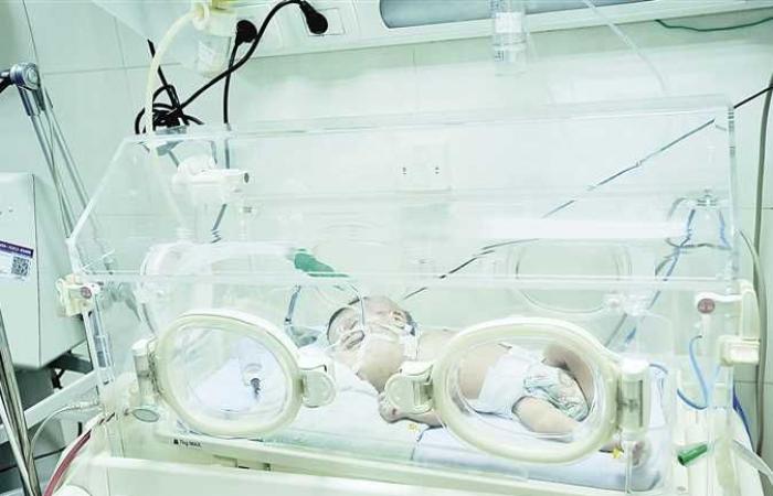 رئيس وحدة القلب بأبو الريش: المستشفى يستقبل 15 ألف طفل سنويا