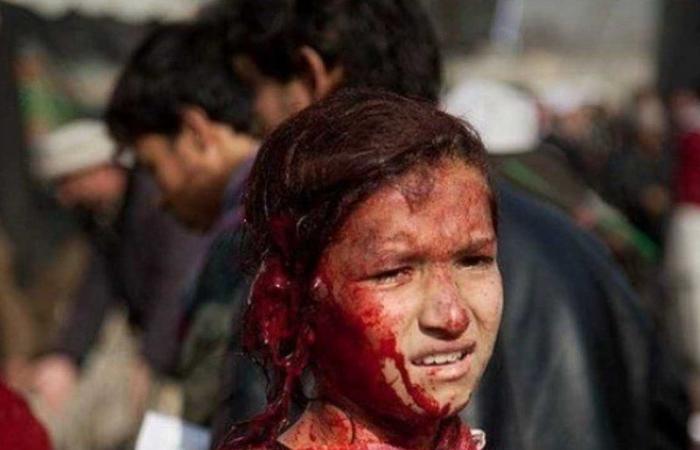 لا تخدعك مواقع التواصل.. حقيقة صورة الطفلة الناجية من هجوم كابول