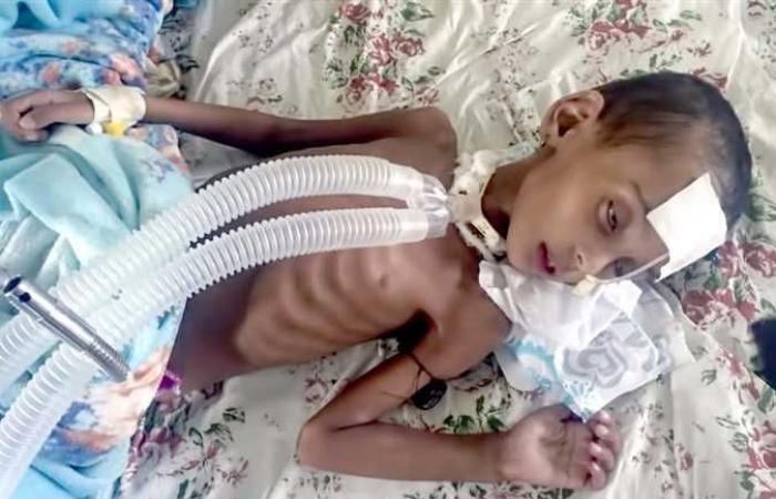 الأمم المتحدة تقول إن مدنيين أصيبوا في غارة جوية على تيجراي بإثيوبيا