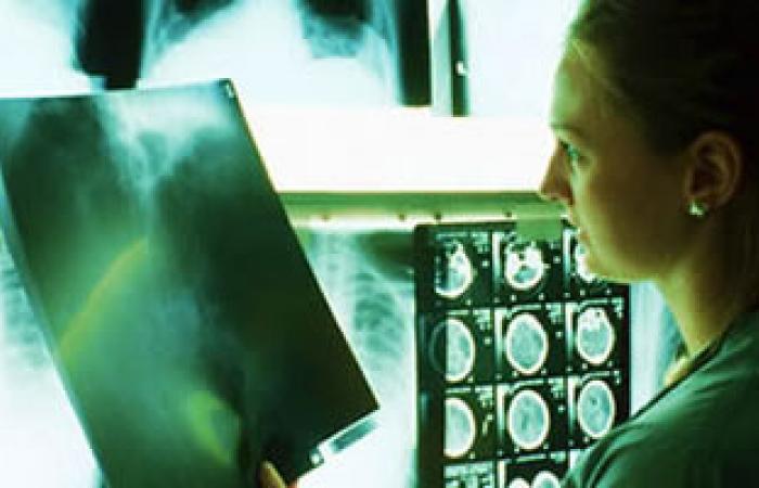 دراسة: الأشعة المقطعية خطر يهدد الأطفال والمراهقين