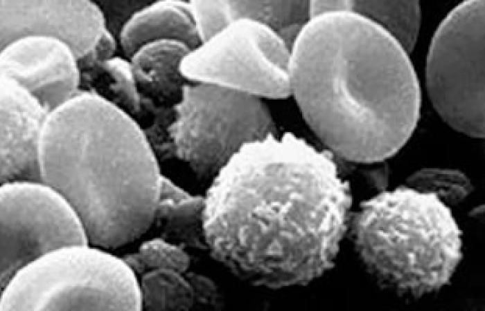 تحويل "جين" كرات الدم البيضاء لتدمير الخلايا السرطانية لمريض لوكيما الدم