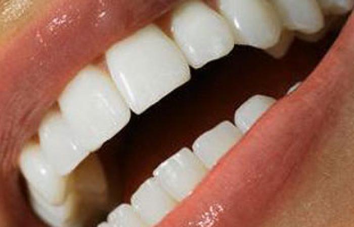 معوقات استخدام الليزر لتبييض الأسنان