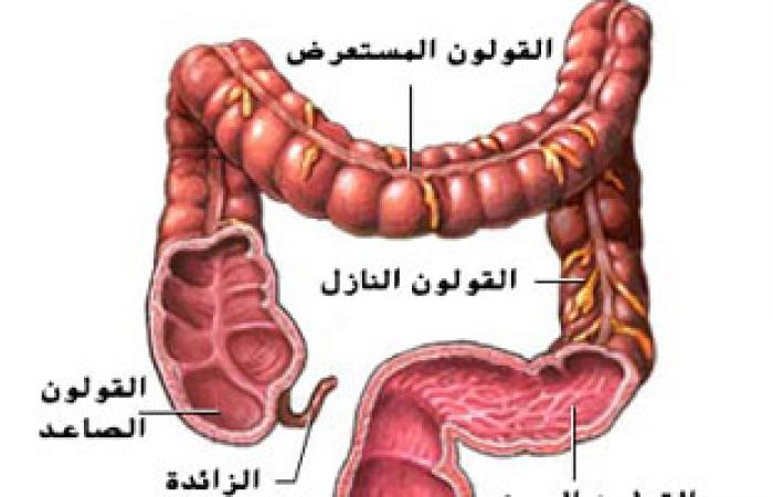 العامل الوراثى وراء سرطان القولون والوقاية بالكشف والفحص المبكر