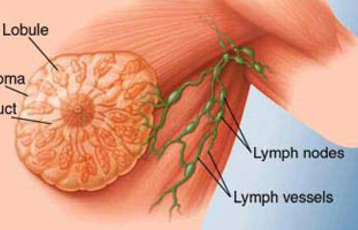 حمالات الصدر ليست لها علاقة بسرطان الثدى