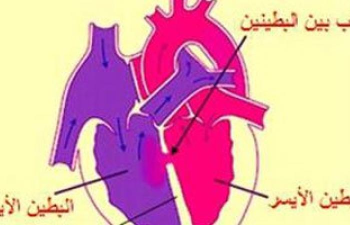 لمرضى القلب.. 7 نصائح لحضور العزومات والاحتفالات دون مضاعفات