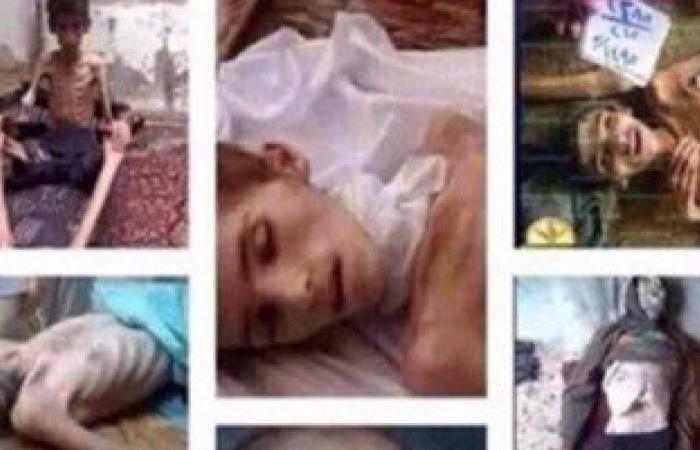 بالصور والفيديو.. أطفال مضايا بسوريا يعانون من الموت البطىء بسبب الجوع