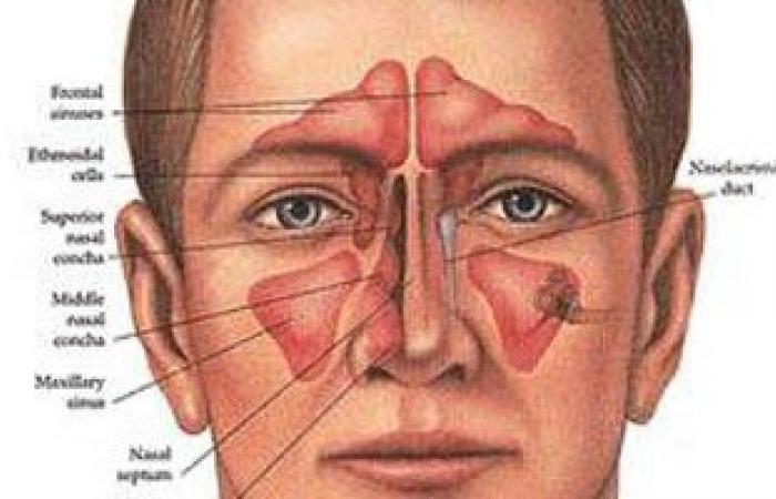 اعمله كمادات لعلاج الجيوب الأنفية.. الأناناس مش للأكل بس