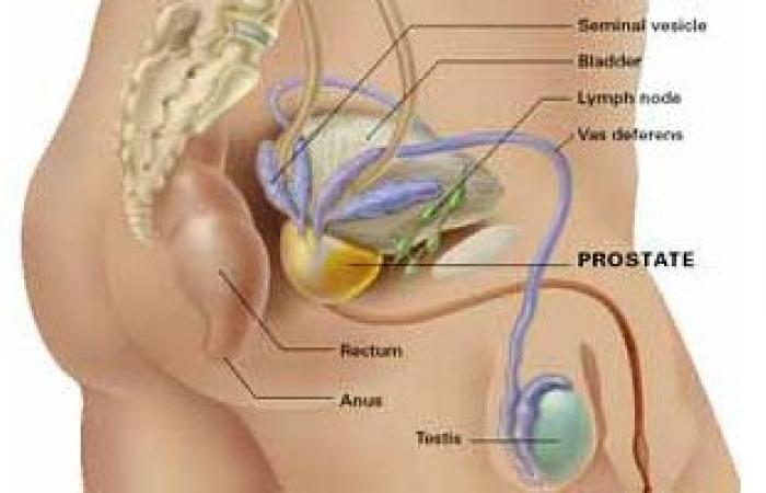 احتقان البروستاتا أسبابه وأهم المضاعفات.. اعرفها واحمى نفسك