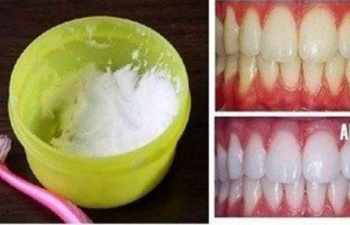 وصفة طبيعية مذهلة لتبييض الأسنان فى دقيقة واحدة