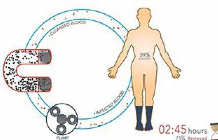 بالفيديو.. أحدث جهاز لعلاج الملاريا باستخدام "فلتر مغناطيسى" ينقى الدم