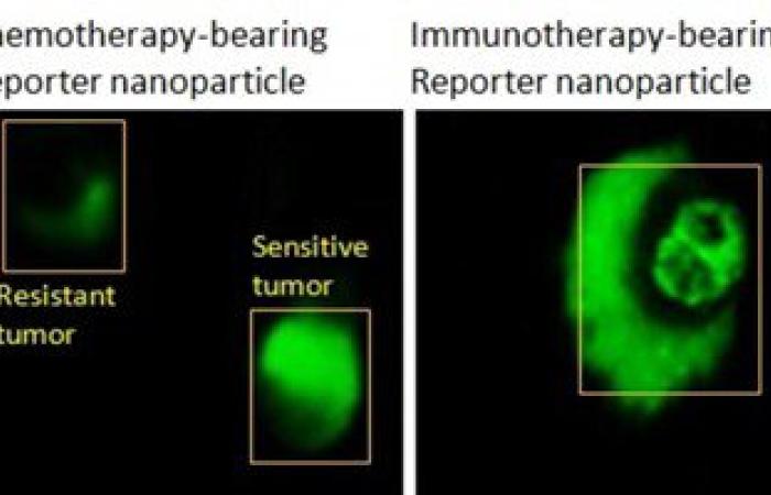لتقليل المضاعفات.. تقنية جديدة تكشف فعالية العلاج الكيماوى بعد 8 ساعات