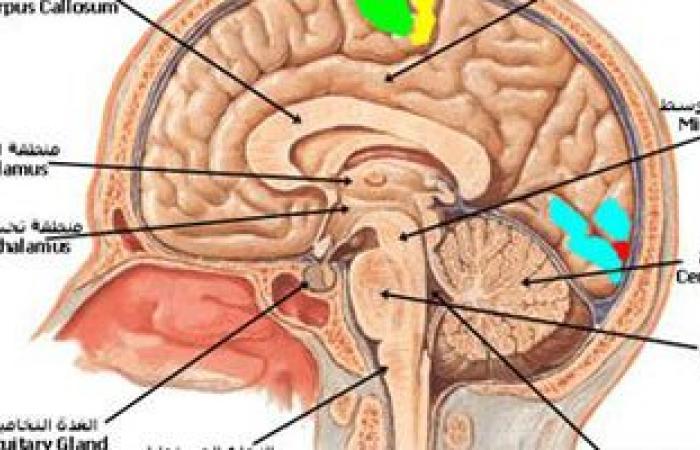 أستاذ مخ وأعصاب يقدم 6 طرق أساسية تؤدى للإصابة بالجلطة الدماغية