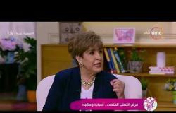السفيرة عزيزة - د/ مجد زكريا يشرح كيفية تشخيص مرض " التصلب المتعدد "