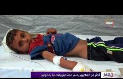 الأخبار - انطلاق أول حملة للتطعيم ضد مرض الكوليرا في اليمن تستهدف 350 ألف شخص