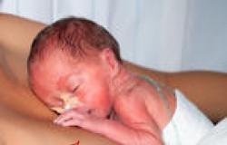 الولادة المبكرة ونقص نمو الطفل من أضرار سوء التغذية خلال الحمل