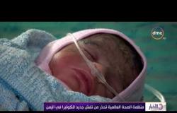 الأخبار - منظمة الصحة العالمية تحذر من تفش جديد للكوليرا في اليمن
