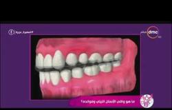السفيرة عزيزة - د/ عايدة مصطفى توضح أنواع واقي الأسنان الليلي