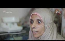 مصر تستطيع - " نوره " السرطان خطف منها " رئة " وناقشت الماجيستير على جهاز تنفس