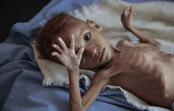 الكوليرا تستفحل في اليمن... مليون و700 ألف إصابة حتى الآن