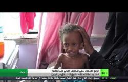 استمرار معاناة أطفال اليمن بسبب الحرب