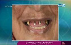 وبكرة أحلى |  د. محمود حشمت زمالة تجميل الأسنان جامعة مانشيستر