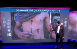 فلسطيني أعزل يتلقى رصاصة مطاطية في ظهره وتنديد واسع بتصرف مجندة إسرائيلية