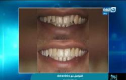 إزي الصحة| د. أشرف عيد أخصائي طب وجراحة الفم والأسنان