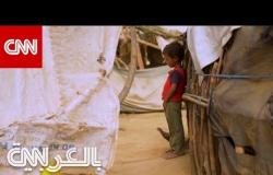 "جحيم اليمن".. حرب ومجاعة وجائحة كورونا وتعليق للمساعدات الإنسانية