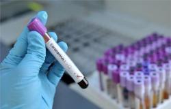 الجزائر تسجل 179 إصابة جديدة بفيروس كورونا و5 حالات وفاة