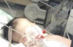 المحكمة تنتصر لرضيعة "العارضة" وتصدر حكماً ضد طبيبة بدفع الدية