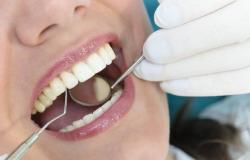 دراسة سويدية تُحذّر من "فقدان الأسنان": قد ينبئ بالإصابة بمرض مناعي