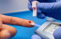 الروس يحصلون على براءة اختراع لتكنولوجيا التحكم بمستوى السكر في الدم دون وخز