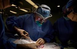 زرع قلب خنزير في جسم إنسان... «بطولة علمية» تمهد لأزمة نقص الأعضاء (خبراء)