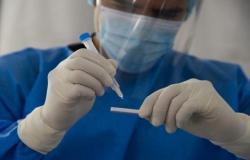 مكافحة الأوبئة : خطورة انتقال مرض ماربوغ للأردن منخفضة حاليا
