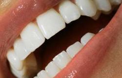 معوقات استخدام الليزر لتبييض الأسنان