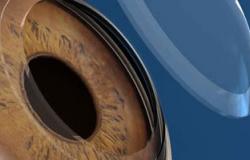 الجارديان: إمكانية استخدام الخلايا الجذعية الجنينية فى استعادة البصر