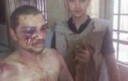 «العفو الدولية» تطالب بالتحقيق في أعمال تعذيب ارتكبها أنصار مرسي