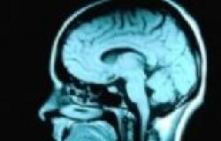 دراسة: حجم المخ يعتبر مؤشرا على الإصابة باضطرابات الطعام