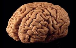 حجم المخ قد يعد مؤشرا على اضطرابات الطعام