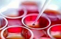 استخدام تحليل الدم "بروتين" CA125فى الاكتشاف المبكر لسرطان المبيض