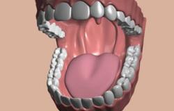إهمال الأسنان يؤدى إلى الإصابة بسرطان الغدد اللعابية