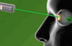 أطباء العيون يحذرون من الأضرار الناجمة عن أشعة الليزر